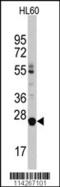 Lin-28 Homolog B antibody, 58-046, ProSci, Western Blot image 