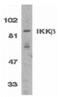 Inhibitor Of Nuclear Factor Kappa B Kinase Subunit Beta antibody, PA5-19916, Invitrogen Antibodies, Western Blot image 