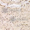 RBP-J kappa antibody, A5675, ABclonal Technology, Immunohistochemistry paraffin image 