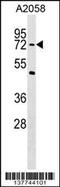 PHD Finger Protein 19 antibody, 59-396, ProSci, Western Blot image 