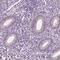 Epididymal sperm-binding protein 1 antibody, PA5-60661, Invitrogen Antibodies, Immunohistochemistry paraffin image 