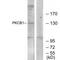 Zinc Finger MYND-Type Containing 8 antibody, A06830, Boster Biological Technology, Western Blot image 