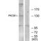 RACK7 antibody, A06830, Boster Biological Technology, Western Blot image 