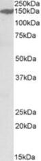 Microtubule Associated Serine/Threonine Kinase 3 antibody, MBS423414, MyBioSource, Western Blot image 