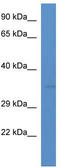 STIM Activating Enhancer antibody, TA333344, Origene, Western Blot image 