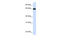 Leucine Rich Repeat Containing 4C antibody, 26-425, ProSci, Enzyme Linked Immunosorbent Assay image 