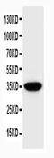 SPARC antibody, PA5-80062, Invitrogen Antibodies, Western Blot image 