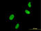 Ubiquitin Like With PHD And Ring Finger Domains 1 antibody, LS-C105136, Lifespan Biosciences, Immunofluorescence image 