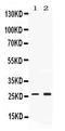 Proteasome subunit alpha type-2 antibody, PB10088, Boster Biological Technology, Western Blot image 