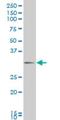 Distal-Less Homeobox 1 antibody, H00001745-M12, Novus Biologicals, Western Blot image 