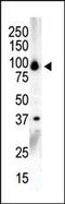 Protein Kinase D3 antibody, PA5-13753, Invitrogen Antibodies, Western Blot image 