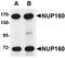 Nucleoporin 160 antibody, orb75029, Biorbyt, Western Blot image 