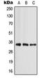 Apolipoprotein E antibody, orb213572, Biorbyt, Western Blot image 