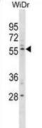 Plexin Domain Containing 1 antibody, abx031017, Abbexa, Western Blot image 