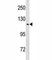 Transient Receptor Potential Cation Channel Subfamily V Member 4 antibody, F46973-0.4ML, NSJ Bioreagents, Western Blot image 