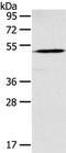 Gamma-Aminobutyric Acid Type A Receptor Rho1 Subunit antibody, TA323067, Origene, Western Blot image 