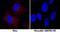 Sequestosome 1 antibody, MAB8028, R&D Systems, Immunocytochemistry image 