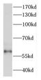 DEAD-Box Helicase 28 antibody, FNab02304, FineTest, Western Blot image 