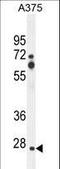 Zinc Finger CCHC-Type Containing 17 antibody, LS-C160744, Lifespan Biosciences, Western Blot image 