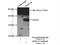 Aldo-Keto Reductase Family 1 Member A1 antibody, 15054-1-AP, Proteintech Group, Immunoprecipitation image 