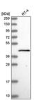 General Transcription Factor IIH Subunit 2 antibody, PA5-65462, Invitrogen Antibodies, Western Blot image 