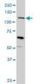 Mucin 4, Cell Surface Associated antibody, H00004585-M07, Novus Biologicals, Western Blot image 