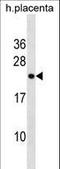 Ring Finger Protein 122 antibody, LS-C158862, Lifespan Biosciences, Western Blot image 