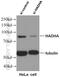 Hydroxyacyl-CoA Dehydrogenase Trifunctional Multienzyme Complex Subunit Alpha antibody, 10758-1-AP, Proteintech Group, Western Blot image 