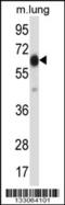 POF1B Actin Binding Protein antibody, 57-299, ProSci, Western Blot image 