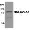Solute Carrier Family 29 Member 3 antibody, TA349153, Origene, Western Blot image 