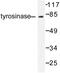 Tyrosinase antibody, LS-C176361, Lifespan Biosciences, Western Blot image 