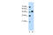 Makorin Ring Finger Protein 1 antibody, 29-840, ProSci, Enzyme Linked Immunosorbent Assay image 