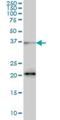 Serine And Arginine Rich Splicing Factor 10 antibody, H00010772-M03, Novus Biologicals, Western Blot image 