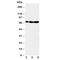 Mitogen-Activated Protein Kinase Kinase Kinase 2 antibody, R30572, NSJ Bioreagents, Western Blot image 