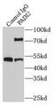 Protein-arginine deiminase type-2 antibody, FNab06104, FineTest, Immunoprecipitation image 