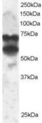 Protein Phosphatase 2 Regulatory Subunit B'Delta antibody, GTX89966, GeneTex, Western Blot image 