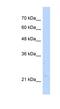 Nudix Hydrolase 16 Like 1 antibody, NBP1-55432, Novus Biologicals, Western Blot image 