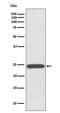 Growth Hormone 1 antibody, M00851-1, Boster Biological Technology, Western Blot image 