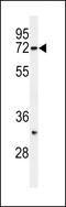 Synoviolin 1 antibody, 61-139, ProSci, Western Blot image 