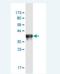 Acetyl-CoA Carboxylase Beta antibody, H00000032-M02A-200ul, Novus Biologicals, Western Blot image 