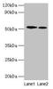 Ribosomal Protein S6 Kinase B2 antibody, LS-C211555, Lifespan Biosciences, Western Blot image 