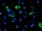 NADH:Ubiquinone Oxidoreductase Subunit A5 antibody, MA5-25767, Invitrogen Antibodies, Immunocytochemistry image 