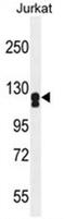 Adenylate Cyclase 2 antibody, AP50086PU-N, Origene, Western Blot image 