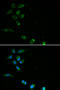 Hereditary hemochromatosis protein antibody, STJ23939, St John
