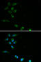 Homeostatic Iron Regulator antibody, STJ23939, St John