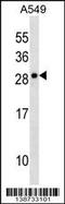 Cardiotrophin Like Cytokine Factor 1 antibody, 60-119, ProSci, Western Blot image 