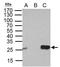 Deoxythymidylate Kinase antibody, GTX114371, GeneTex, Immunoprecipitation image 