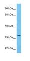 Proteasome Subunit Alpha 8 antibody, orb325398, Biorbyt, Western Blot image 