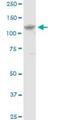 EvC Ciliary Complex Subunit 1 antibody, H00002121-B01P, Novus Biologicals, Western Blot image 