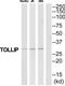 Toll Interacting Protein antibody, TA312386, Origene, Western Blot image 